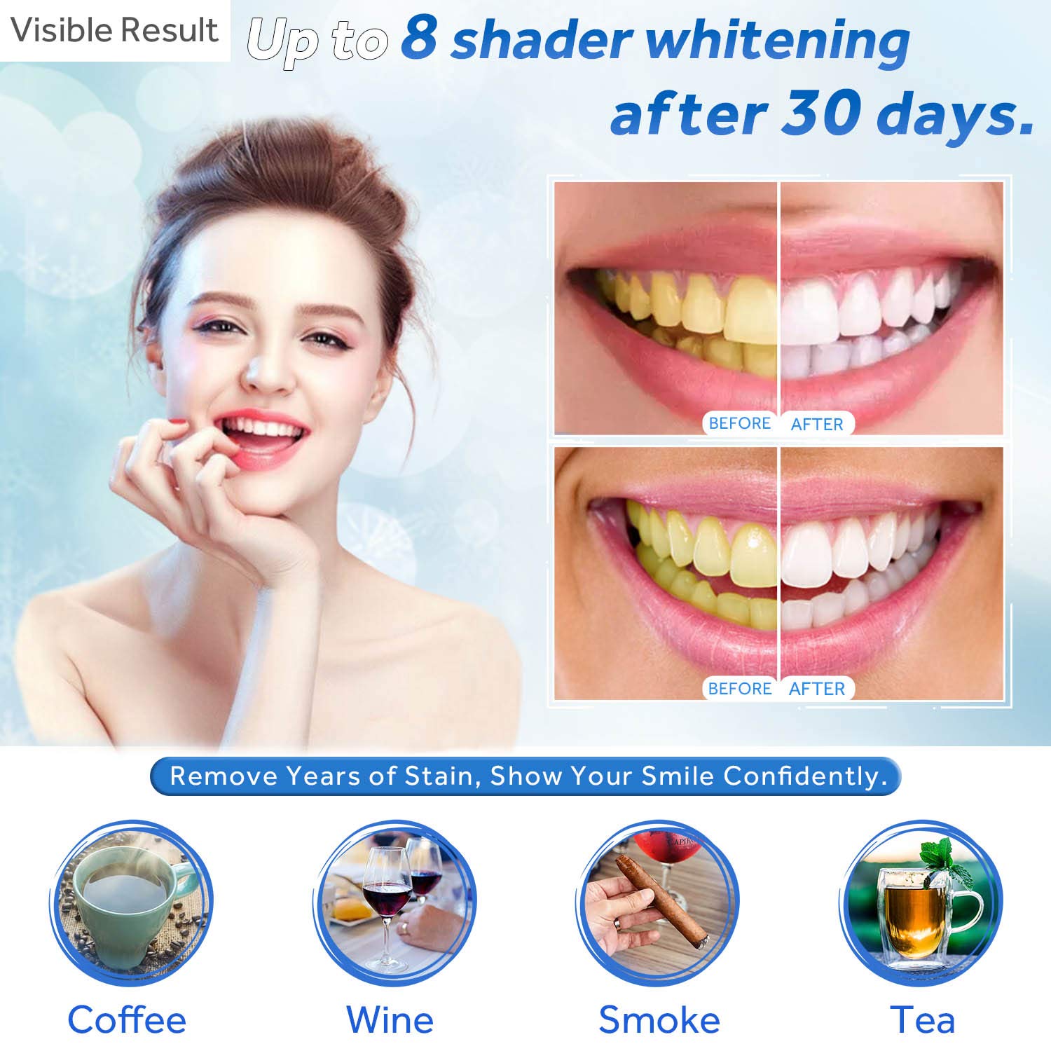 Teeth Whitening Gel Refill Syr - Teeth Whitening Kit review and price
