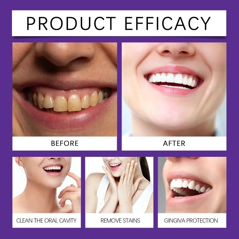 Purple Teeth Restoration Miner - Teeth Whitening Near Me review and price